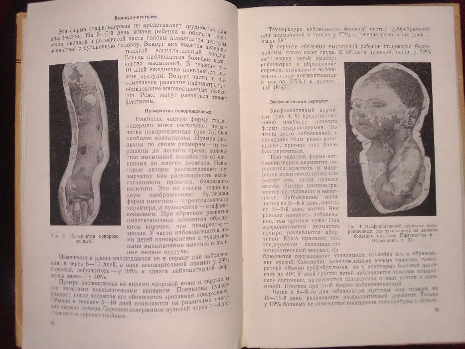 Дерматология. Голосовкер С.Я. Пиодермия у детей, 1960