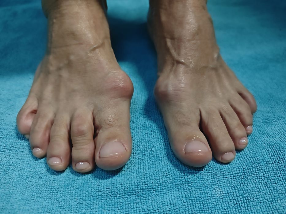 Serviço de pedicure e calista ao domicílio