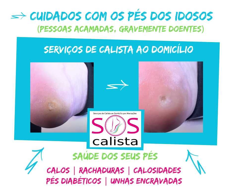 Calista ao Domicílio | Diagnóstico e Tratamento Profissional