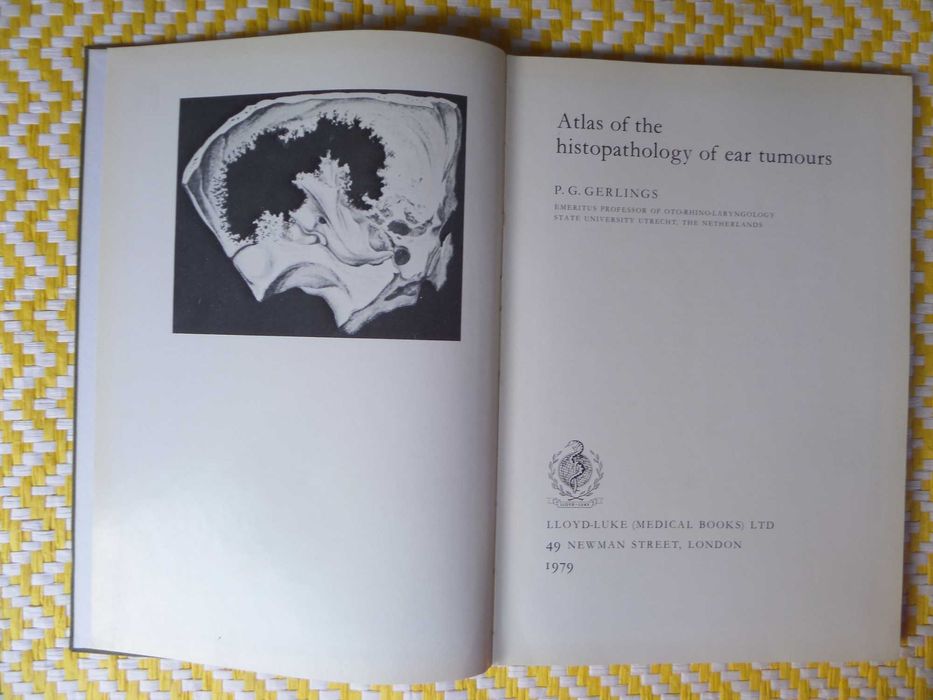 Atlas of the Histopathology of Ear Tumours
P.G. Gerlings