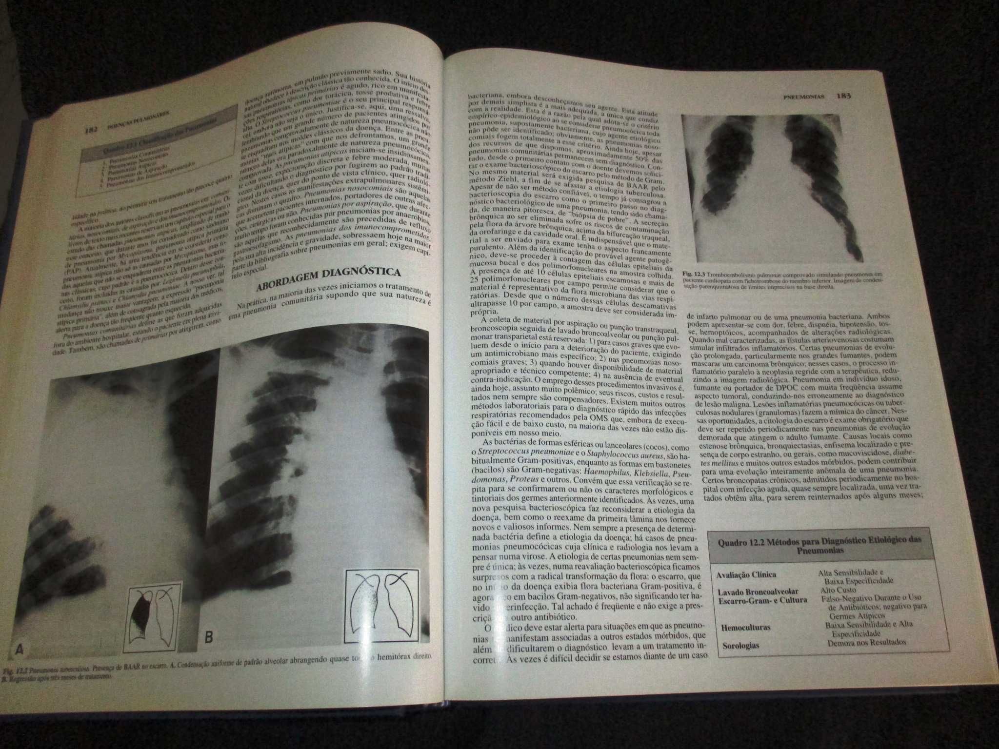 Livro Doenças Pulmonares Tarantino 5ª edição