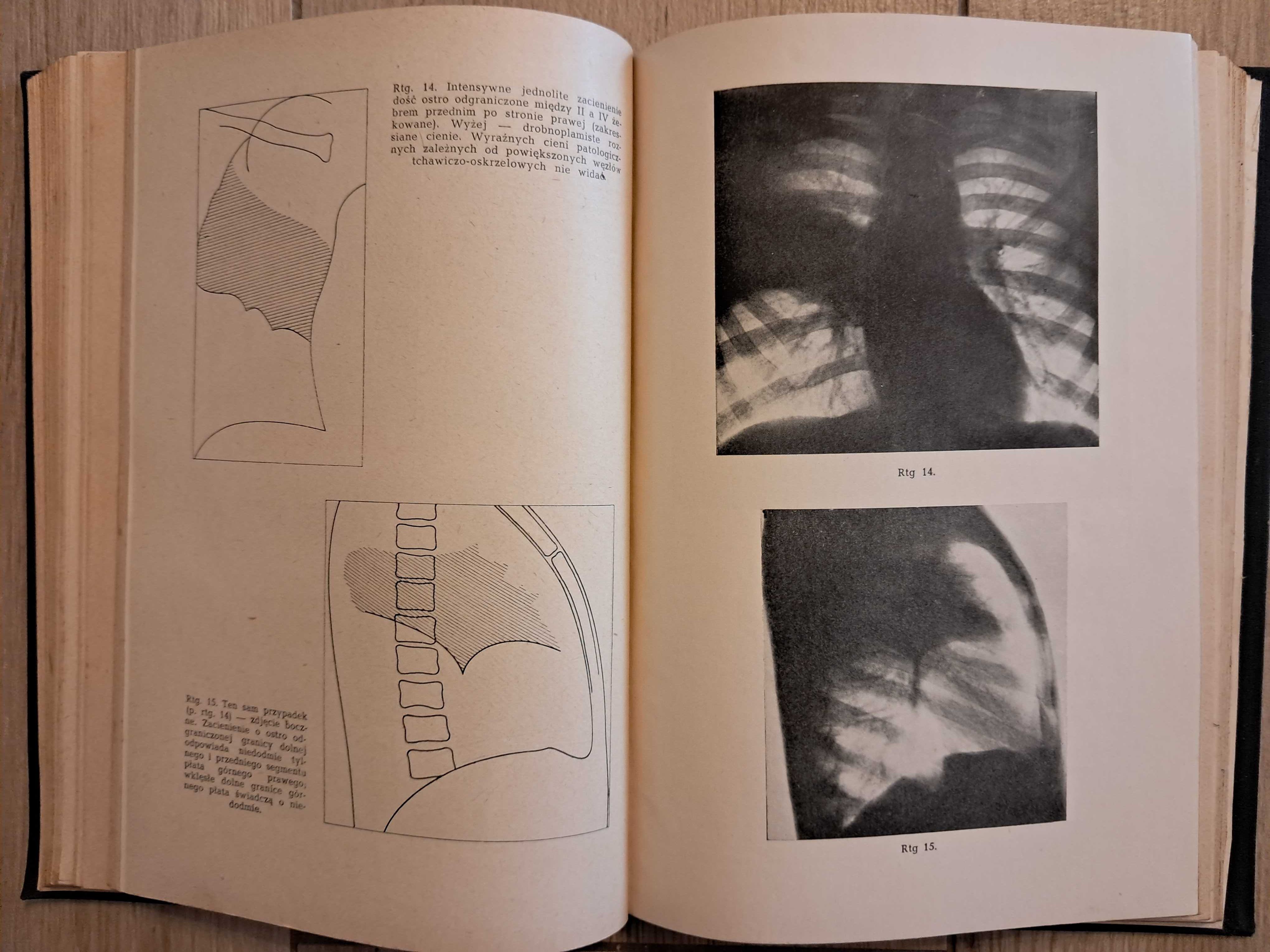 Ftyzjatria - J. Misiewicz - 1954r - podręcznik dla studentów medycyny