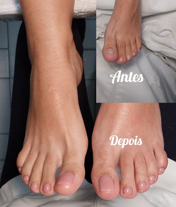Serviço de pedicure e calista ao domicílio