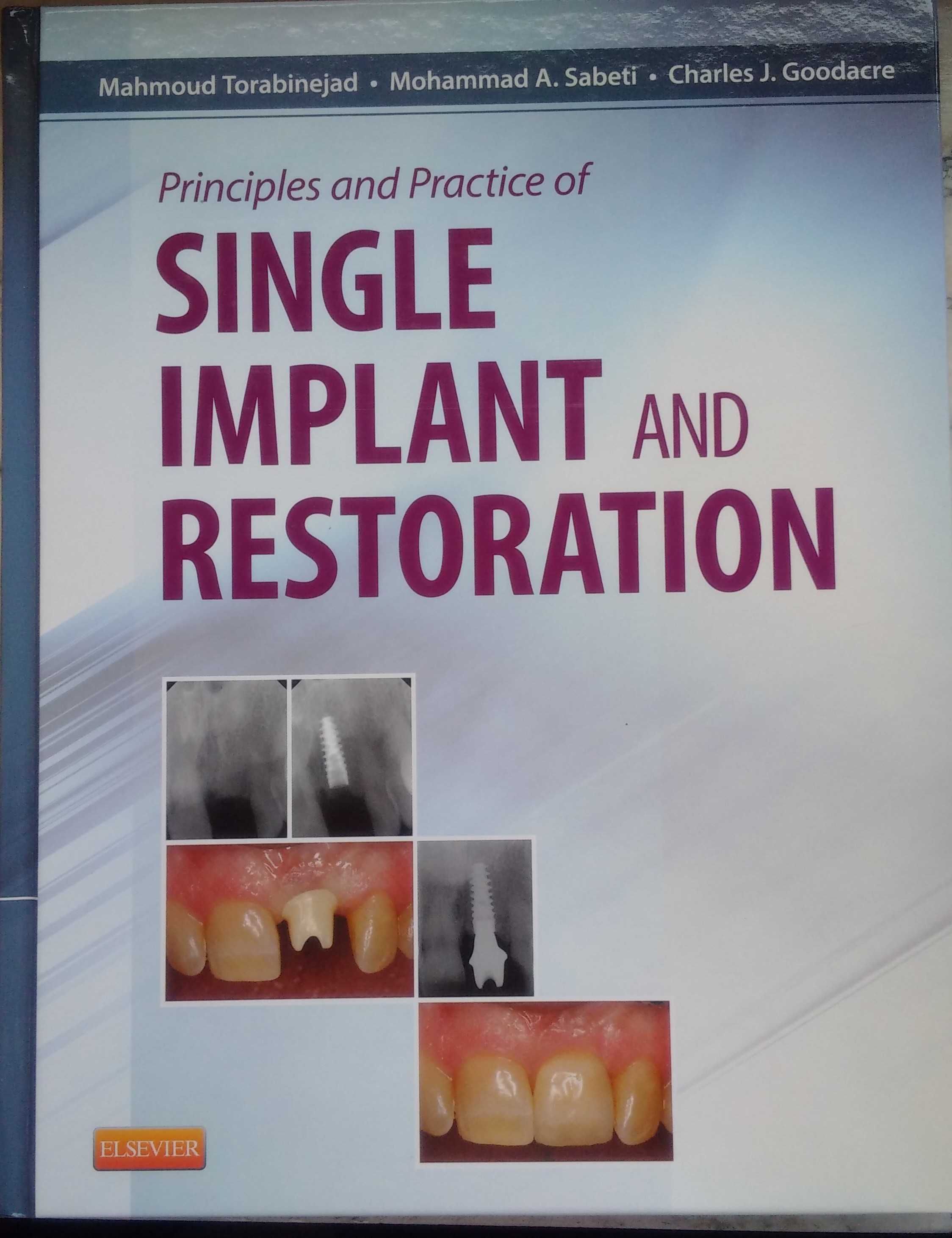 Stomatologia, Implanty, Chirurgia