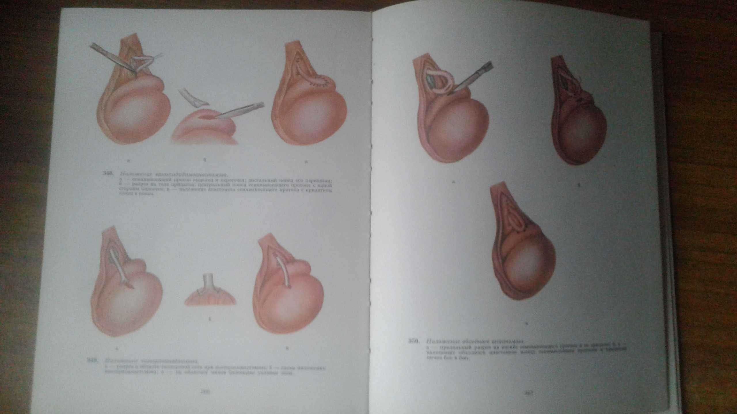 Атлас операций на органах мочеполовой системы