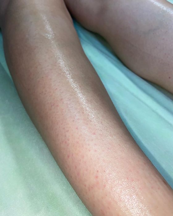 Шугаринг, воскова депіляція. Знижка -10% новому клієнту