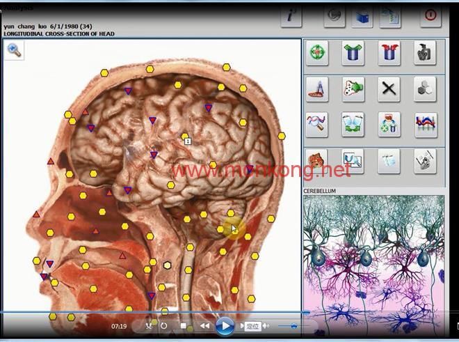 Máquina de Medicina Quântica Bioressonância