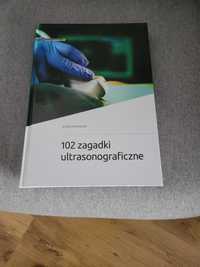 102 zagadki ultrasonograficzne