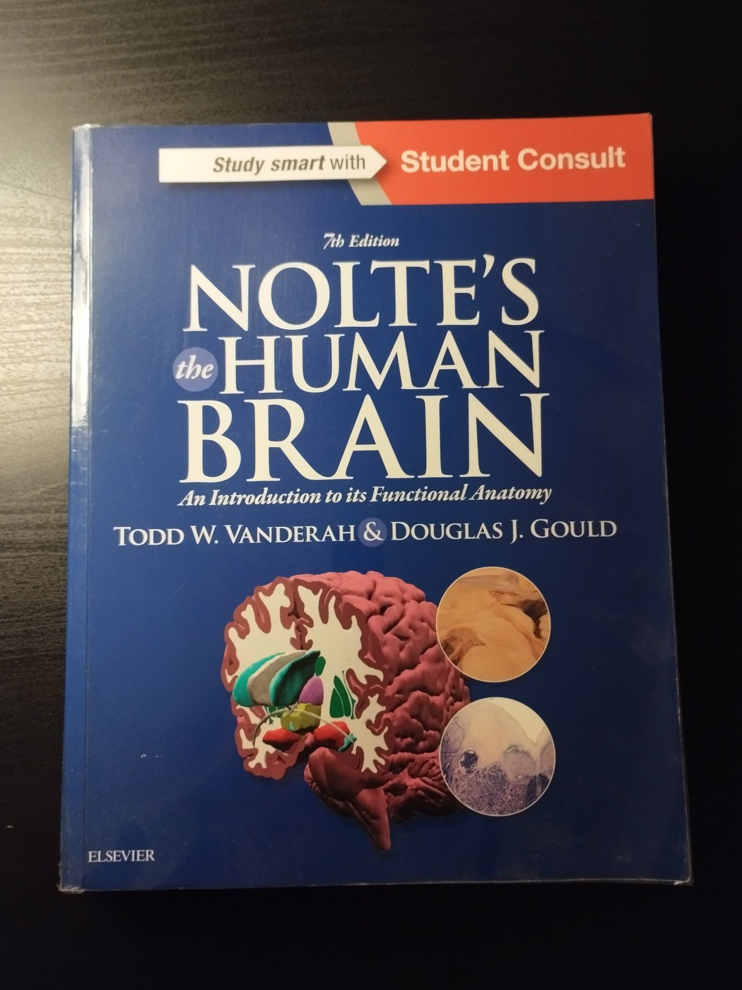 Noltes human brain 7th edition