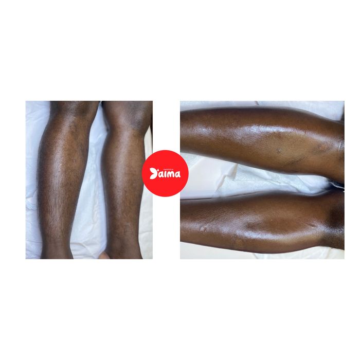 1. Depilação a cera e massagem ao domicílio – Porto e arredores.