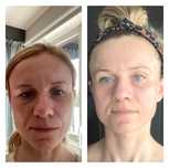 Kobido + taping estetyczny + Gua Sha i masaż calego ciala