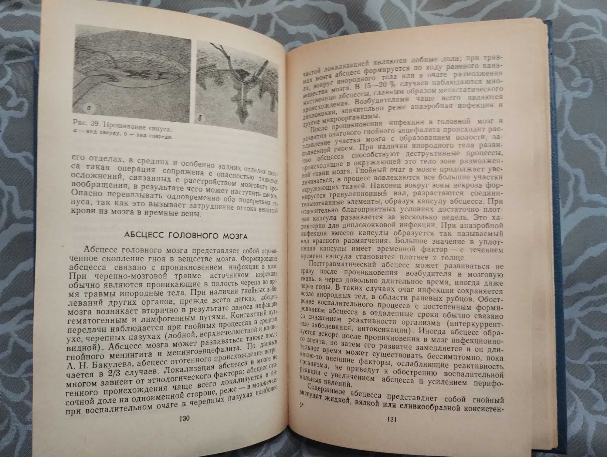 Книга Нейрохирургия А П Ромоданов,Н. М. Мосейчук. Киев 1990 г.