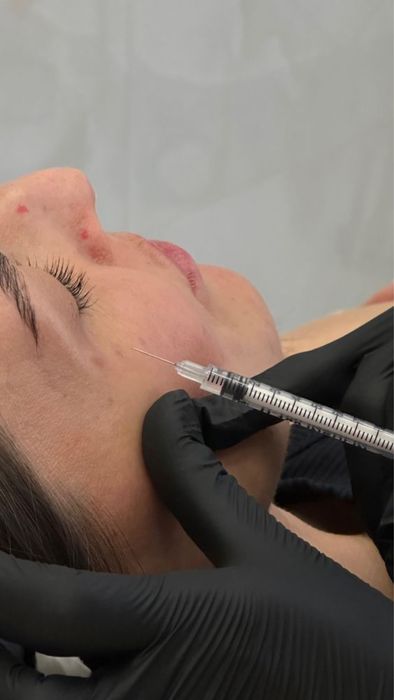 Косметологічні послуги, збільшення губ, ботокс, біоревіталізація,