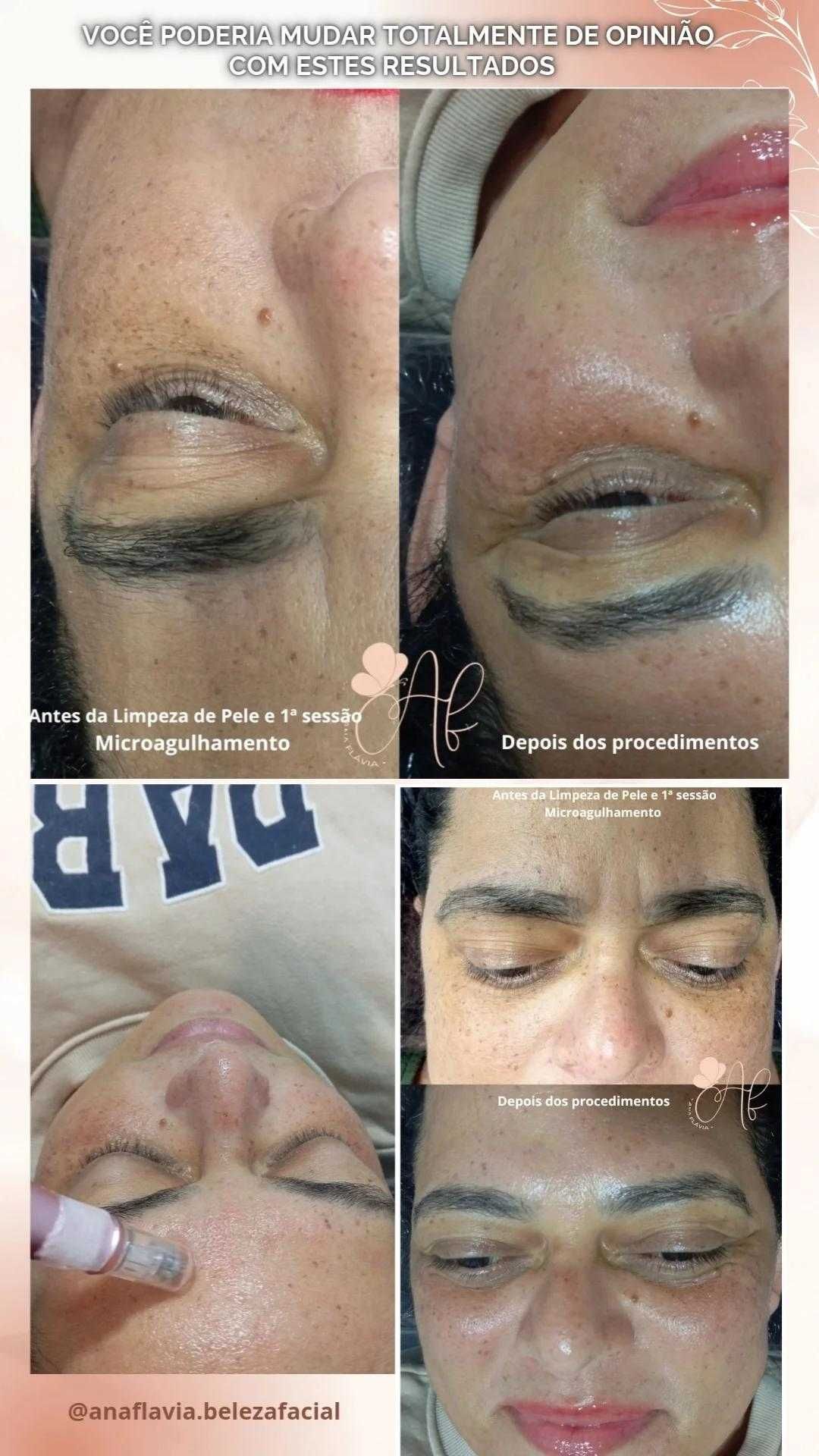 Estética Facial Ana Flávia Martins