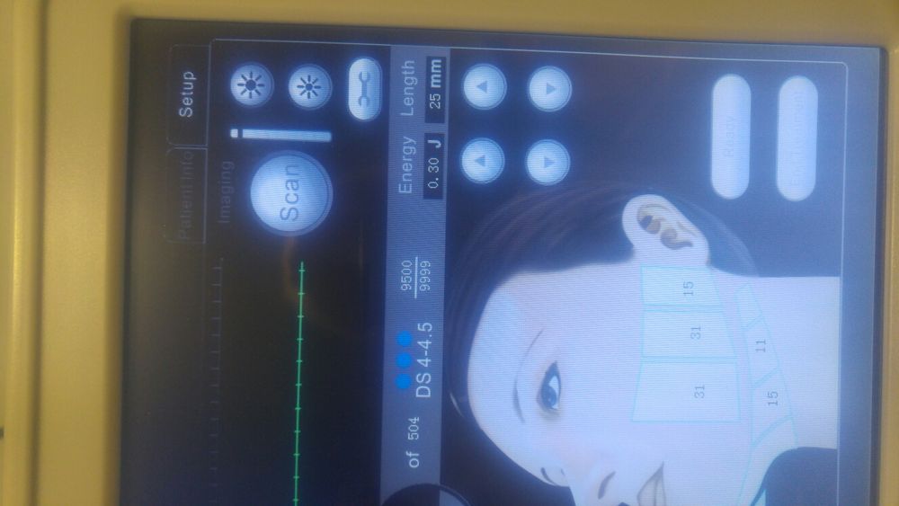 Hifu hifu skalpel bez skalpela likwidacjia salonu