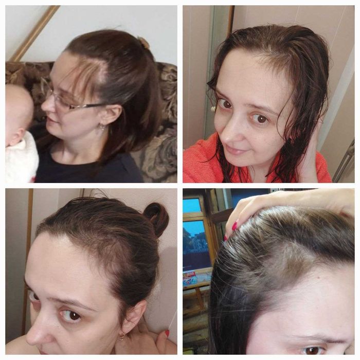 Occuba Сыворотка против выпадения волос