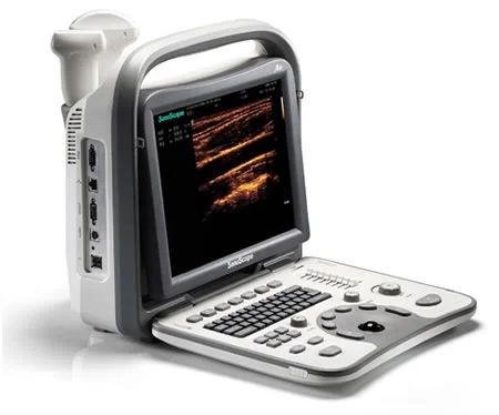 Sonoscape A6 узи сканер узд для ветеринара медика с датчиком