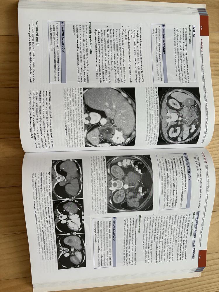 Radiologia W. Herring