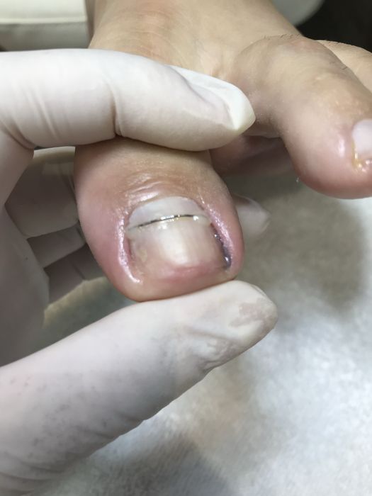 Pedicure medical domiciliar