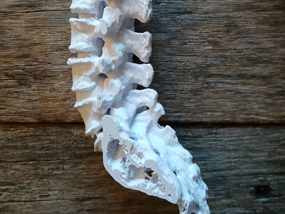 Colunas Vertebrais Pequenas