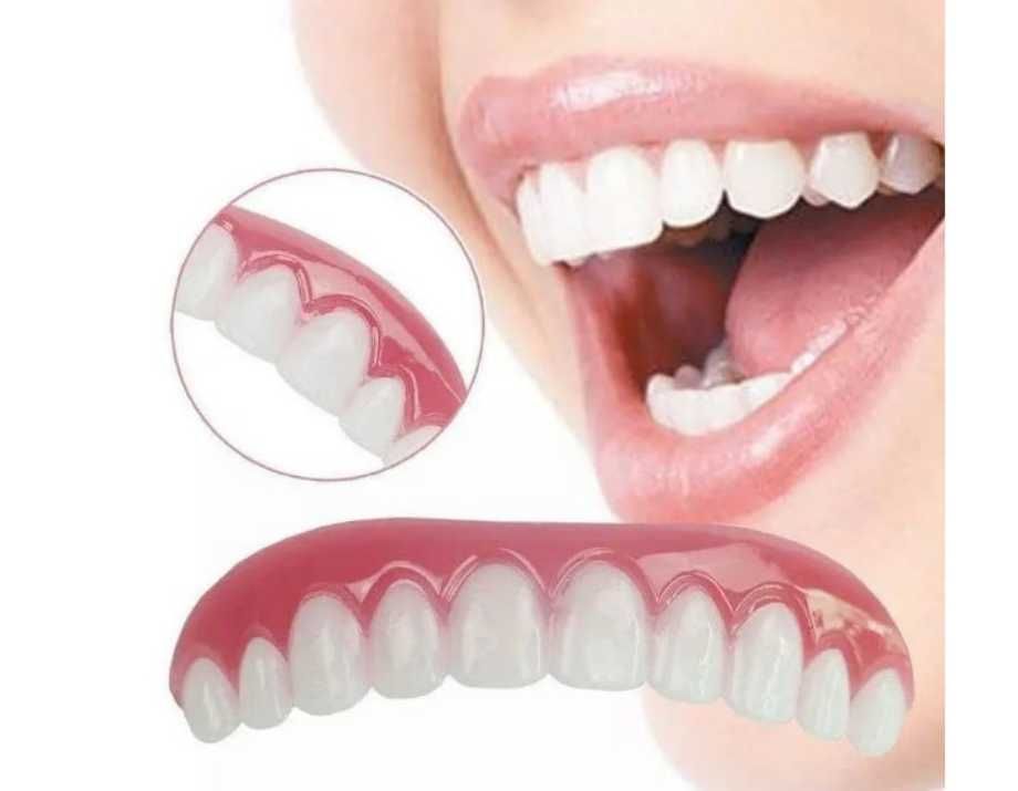 Виниры для зубов Perfect Smile Veneers