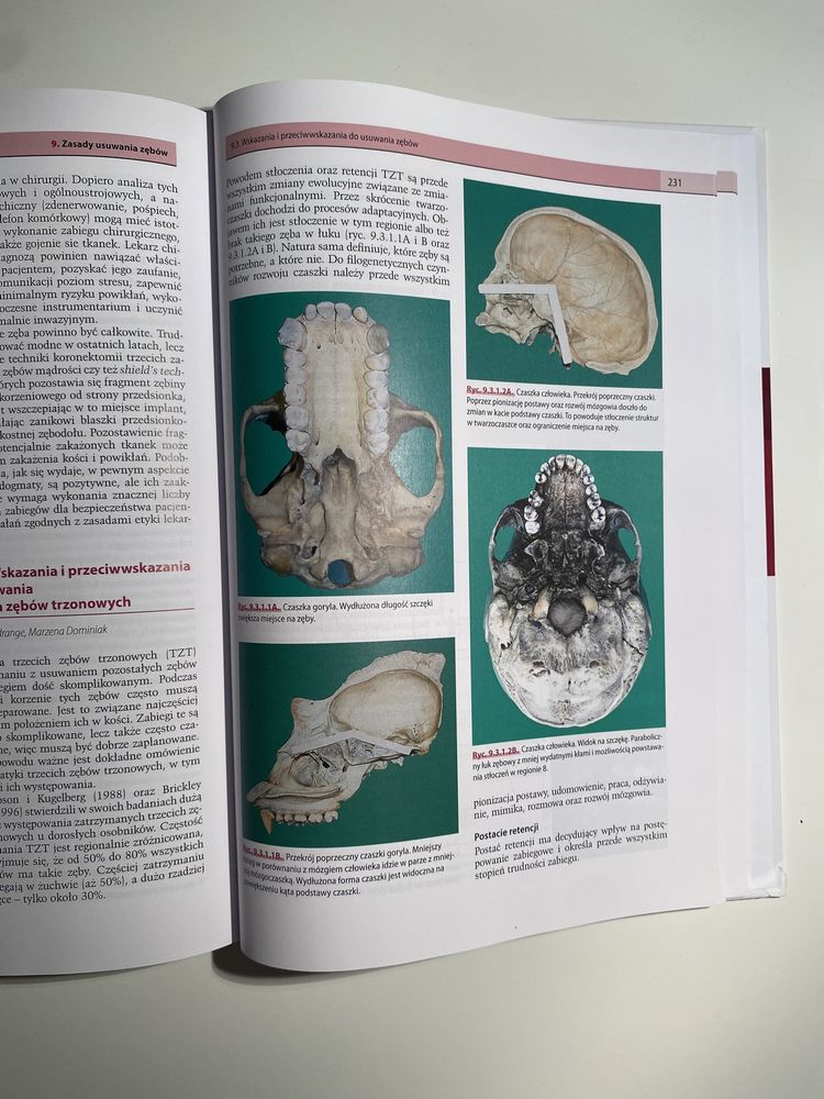 Podstawy chirurgii stomatologicznej - Marzena Dominiak