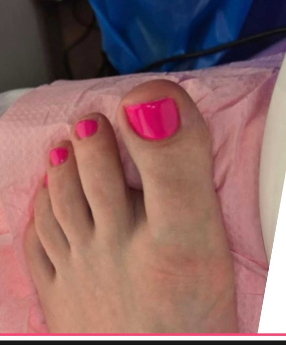 Pedicure podologiczny