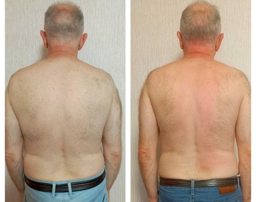 Остеопат, лечение мышечной боли.