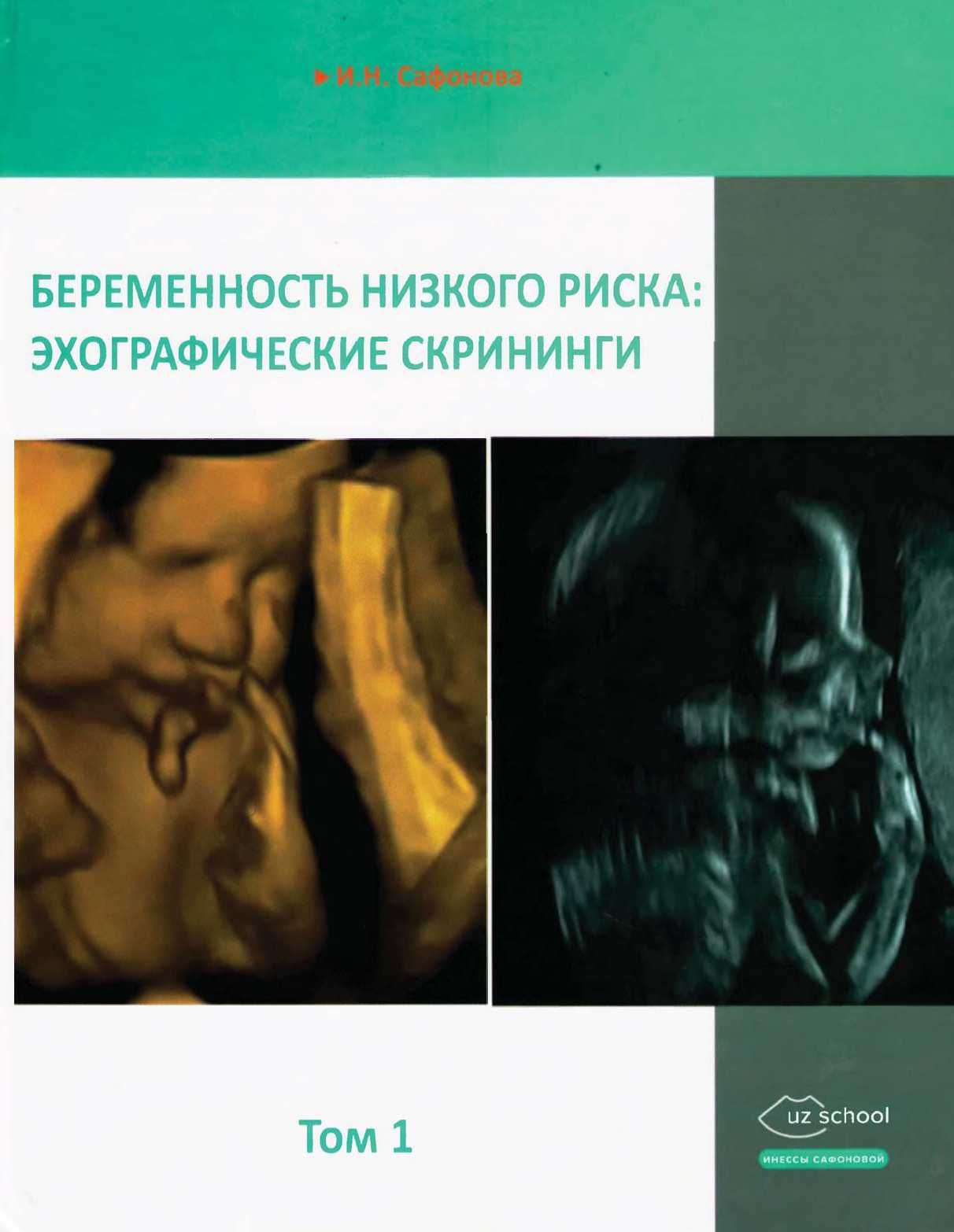 Беременность высокого риска Сафонова