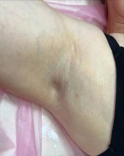 Депіляція/шугаринг