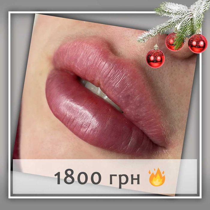 Увеличение губ, контурная коррекция