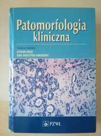 Patomorfologia kliniczna Kruś