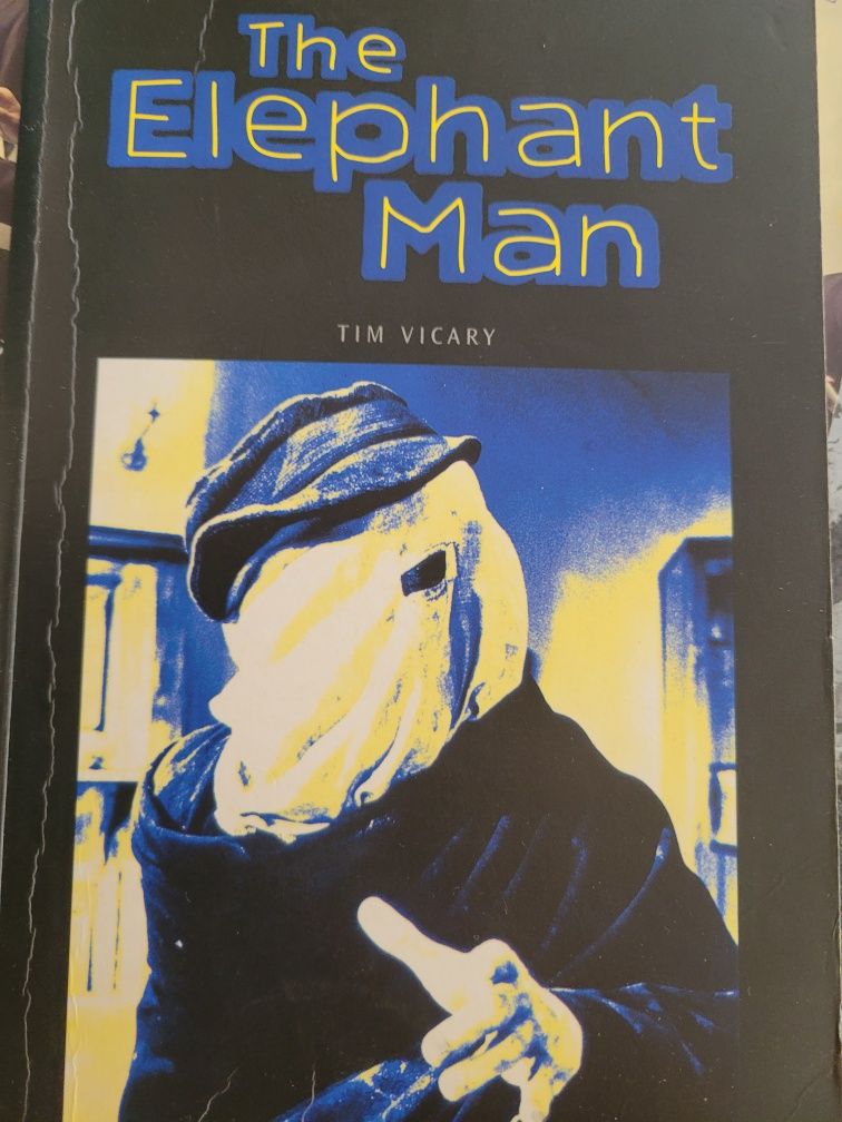 Elephant Man Tim Vicary