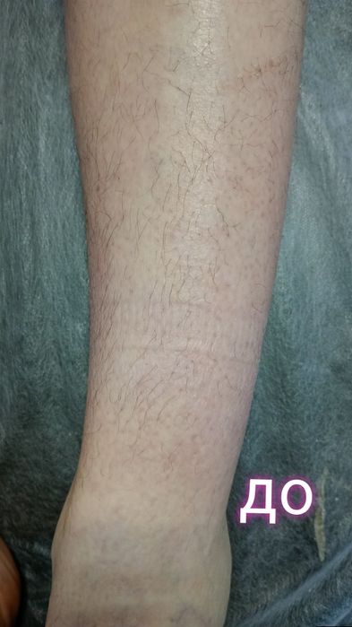 Воскова депіляція