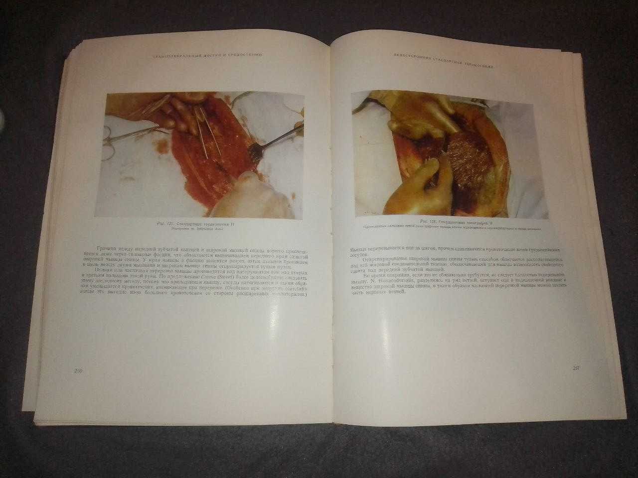 Хирургическая анатомия. Грудная клетка (Проф. Д. Надь) Книга 1963