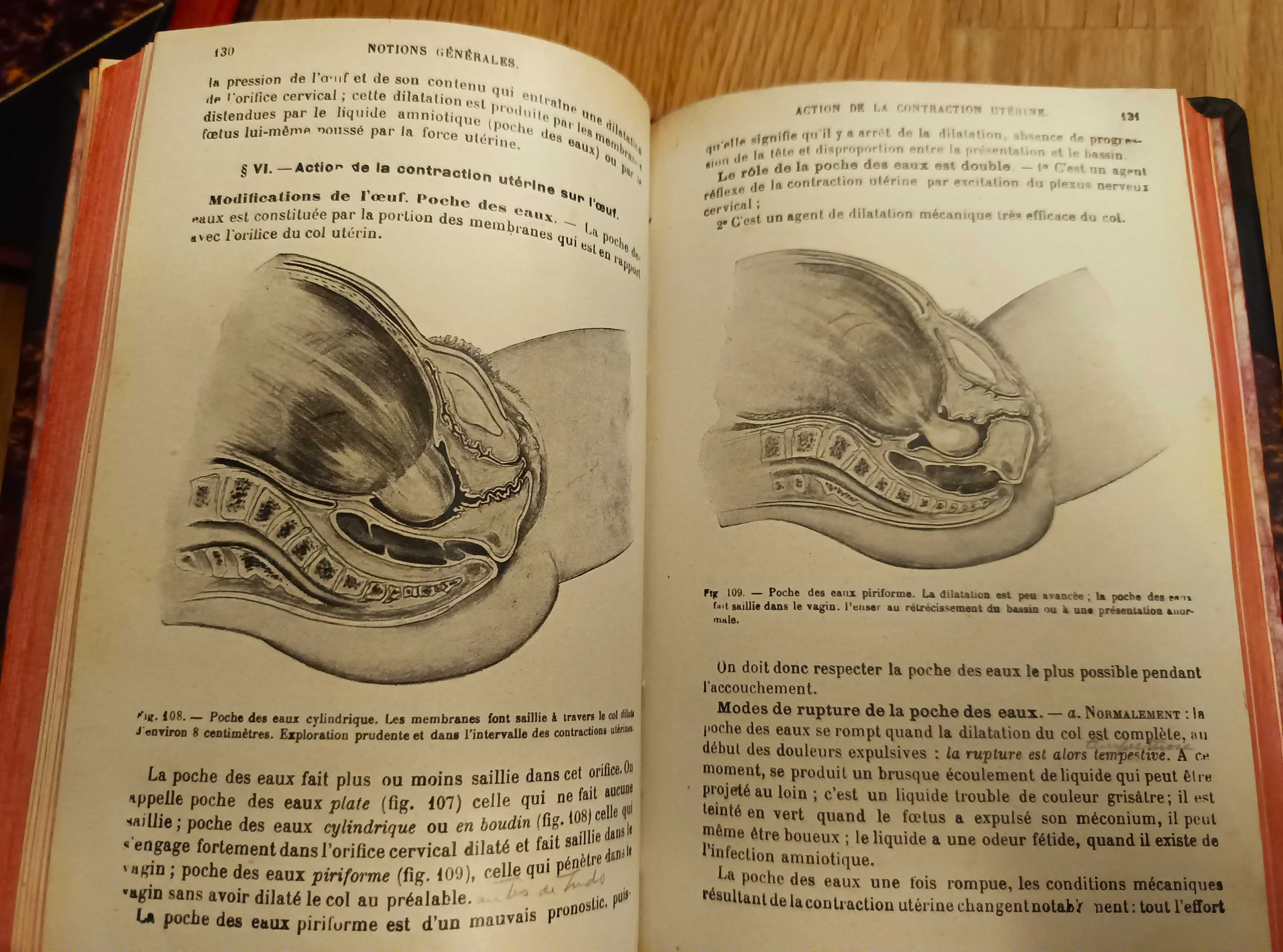 Obstétrique - Fabre (1931 - 2 Volumes)