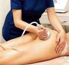 Масаж антицелюлітний Ворзель Буча Немішаєво