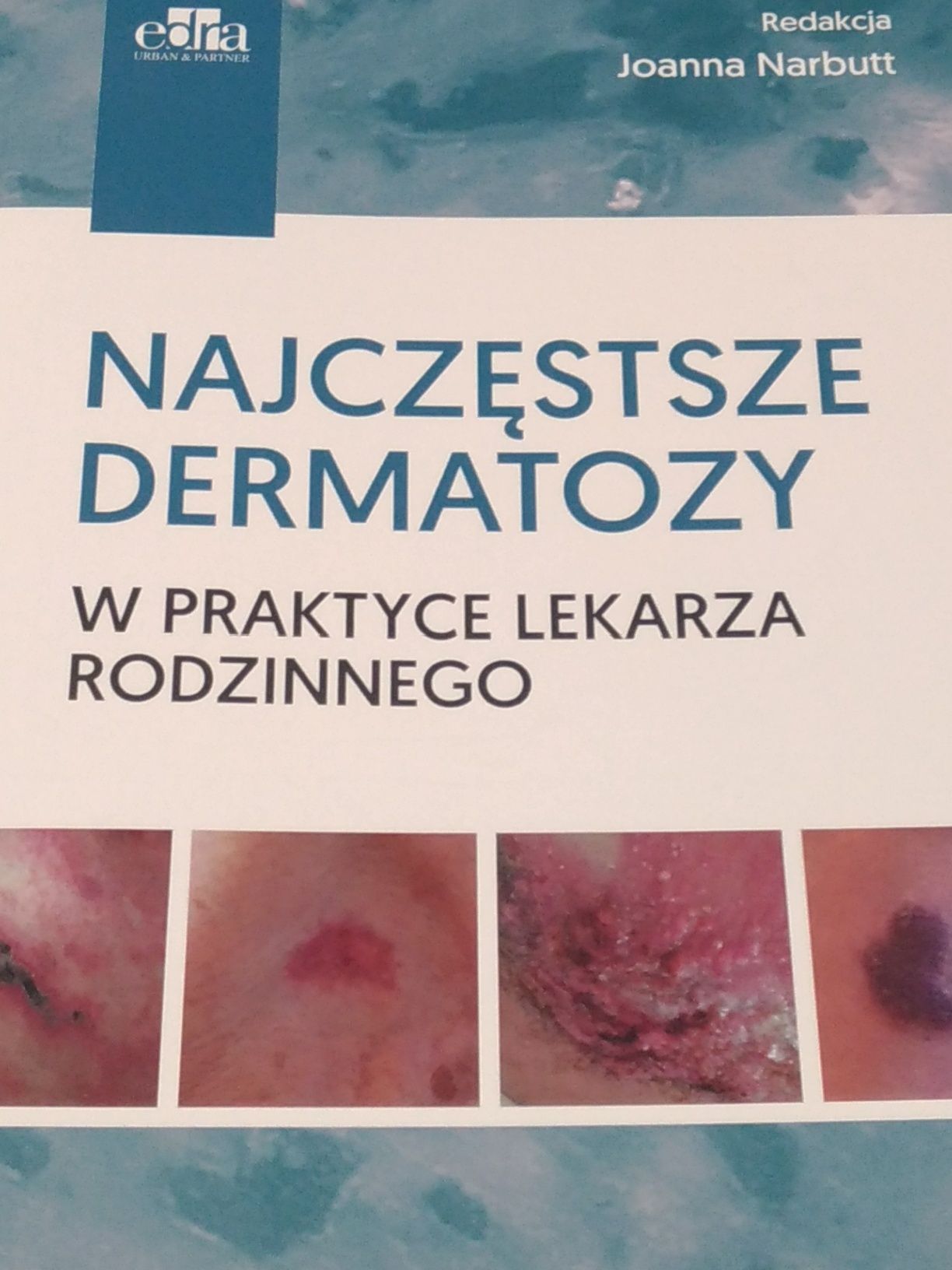 Najczęstsze dermatozy w praktyce lekarza rodzinnego