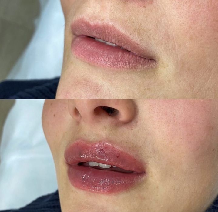 АКЦІЯ  Губи від 1500 грн, модель по собівартості, Київ, палац Україна