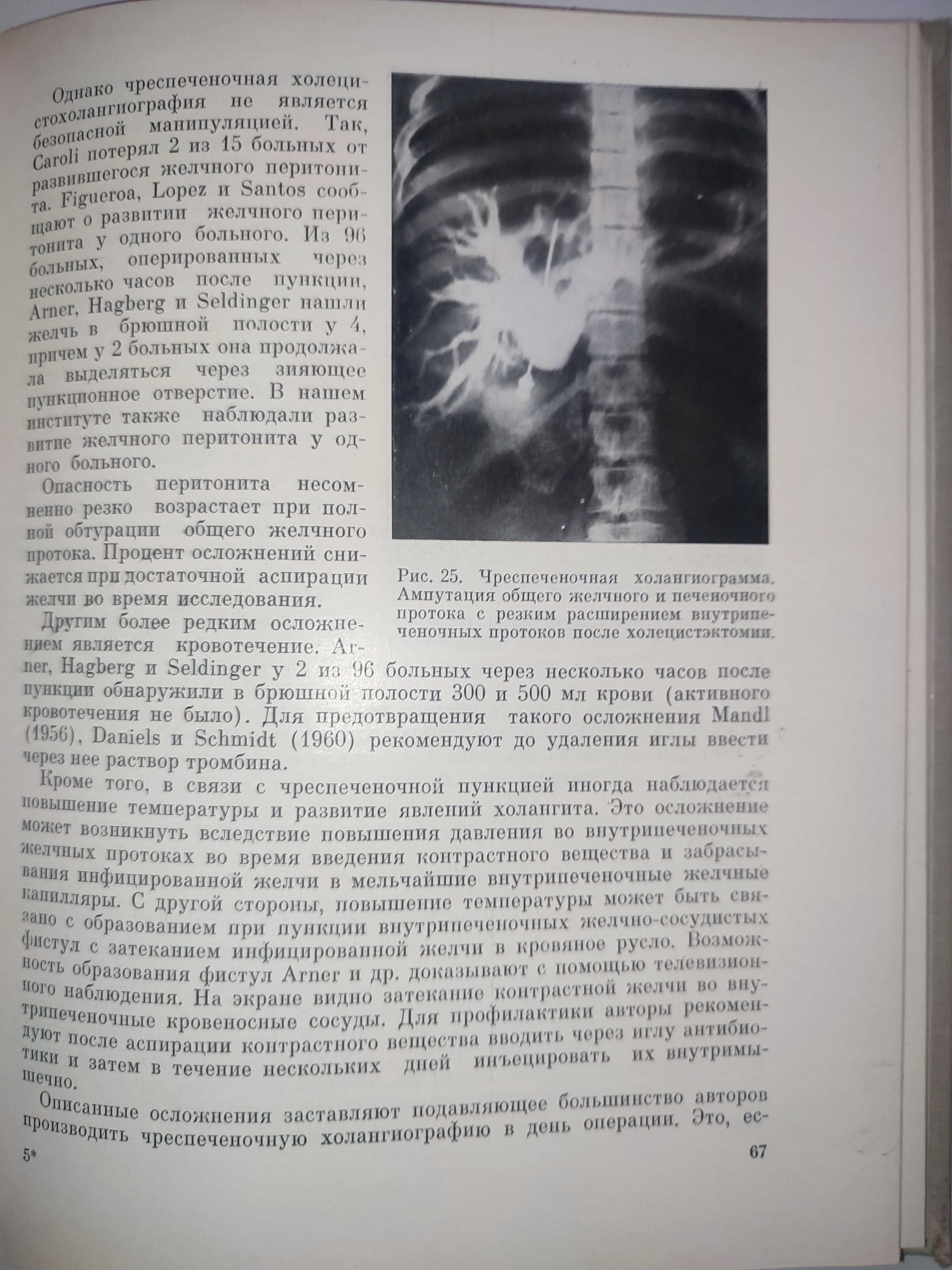 Хирургия внепеченочных желчных протоков Петров Гальперин