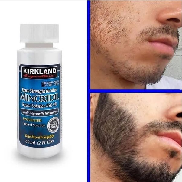 Minoxidil Kirkland e derma roller