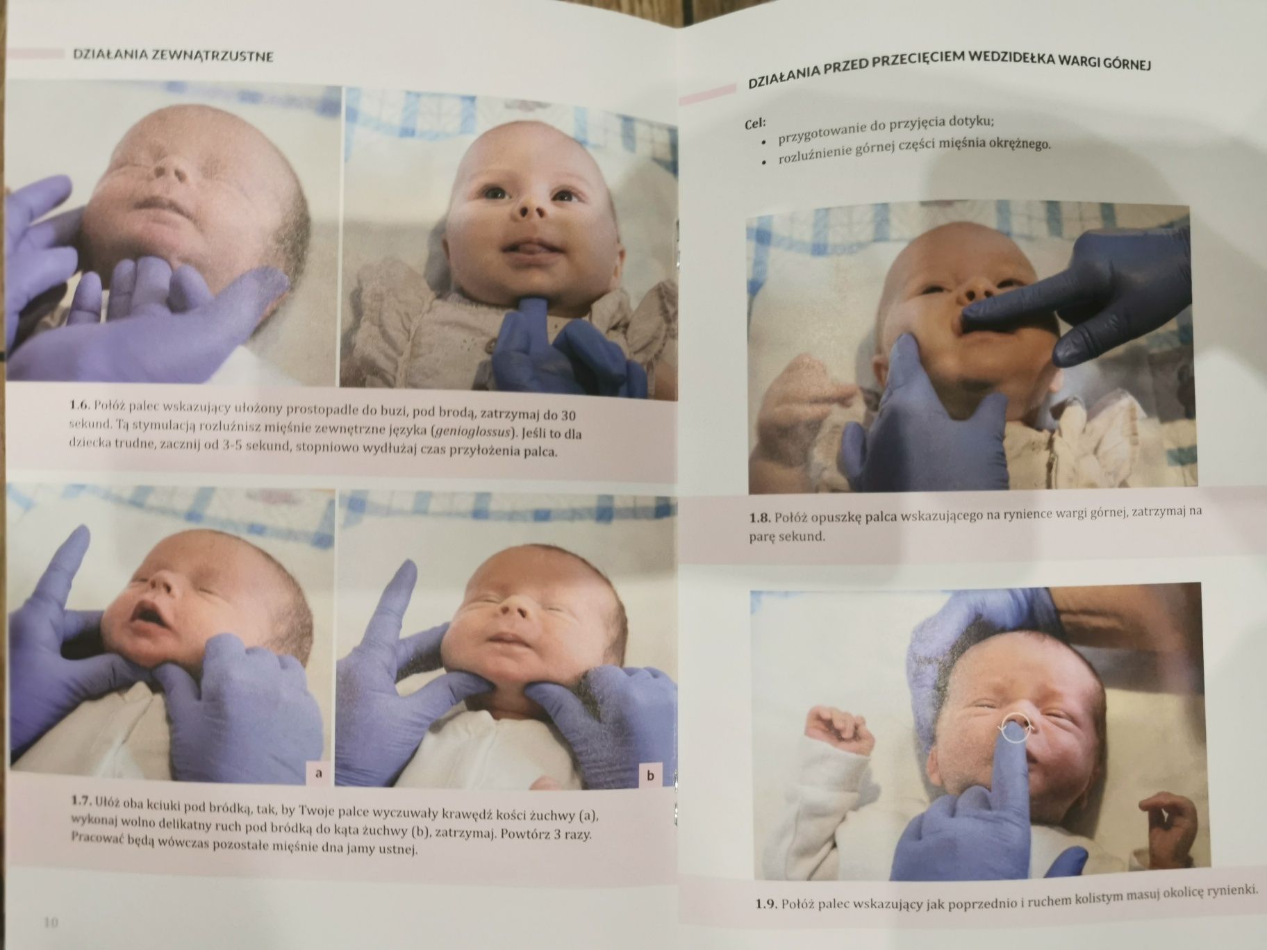 Projekt frenulotomia (podcinanie wedzidelka)