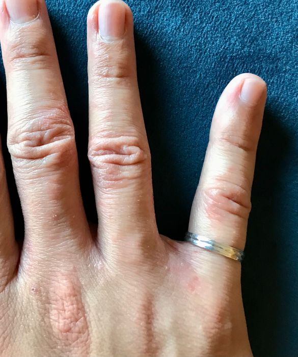 Anel de prata fino e anel de relevo