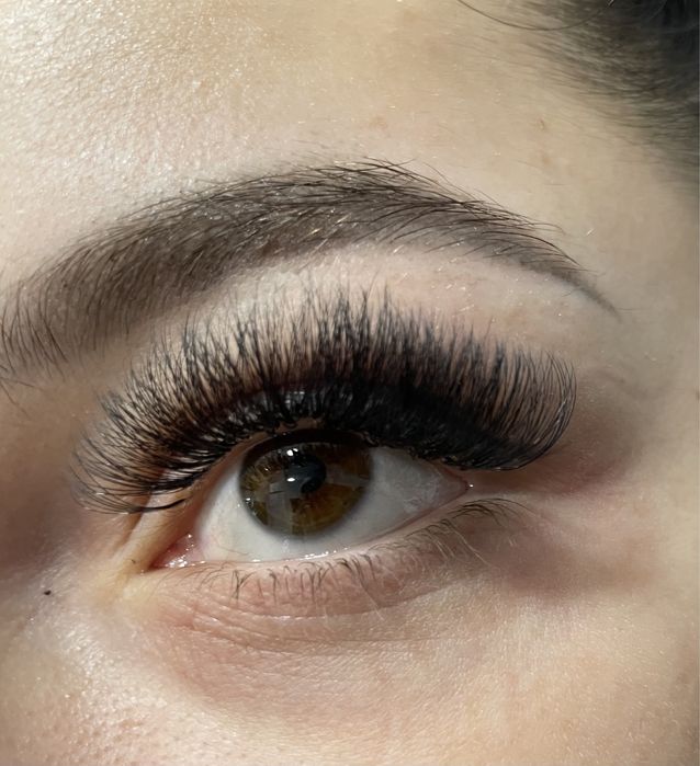 Електроепіляція, шугаринг,лазерна епіляція