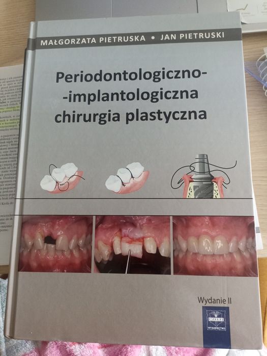 Periodontologiczno-implantologicznq chirurgia plastyczna