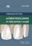 Licówki Porcelanowe Na Zęby Żuchwy I Szczęki