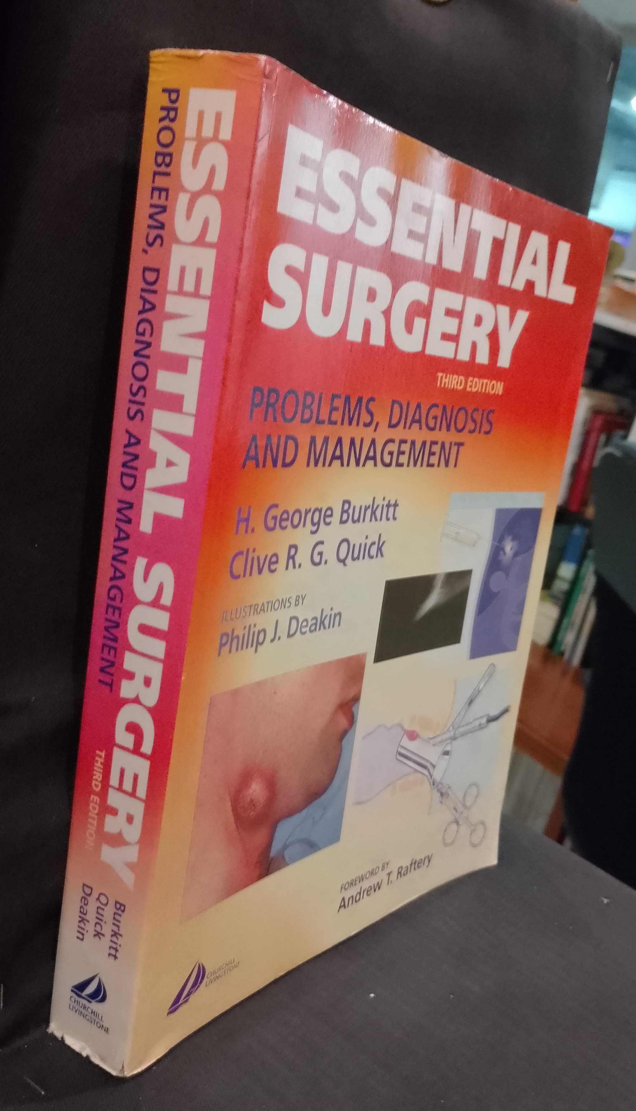 Essential Surgery : Problems, Diagnosis and Management