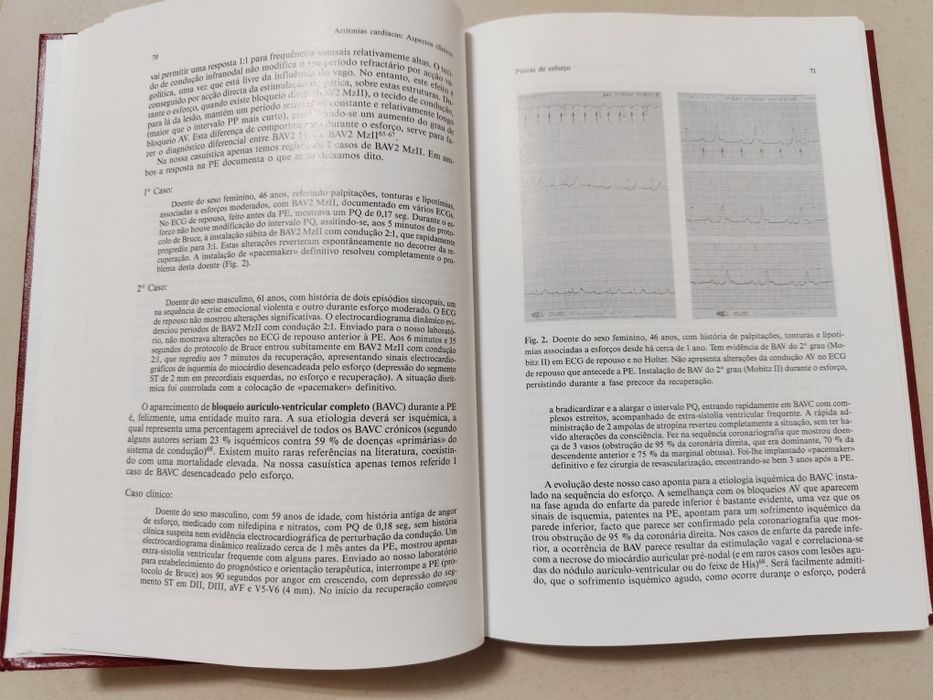 Livro: Arritmias Cardíacas - Aspetos Clínicos - J. Lopo Tuna