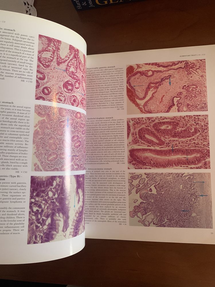 Livro Curran’s Atlas of Histopathology