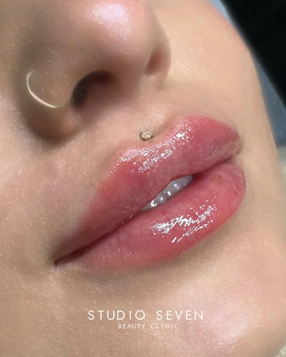 Powiekszanie ust, powiększanie ust